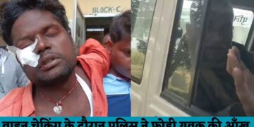 वाहन चेकिंग के दौरान पुलिस ने एक बाइकसवार की फोड़ी आँख