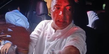 Dr Anil Kumar HAM candidate attack Tekari, टेकारी में हम प्रत्याशी पर हमला, Bihar election violence image, गया में चुनावी हिंसा, police deployed Tekari Bihar